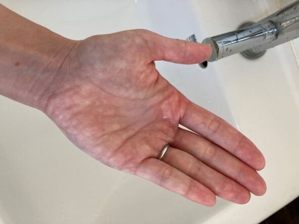 掌の化粧水